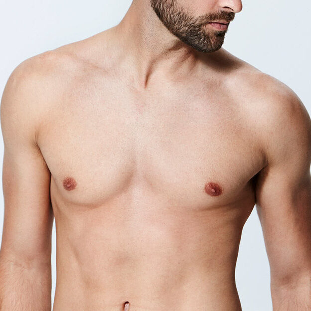 model-laser-hair-removal-for-men